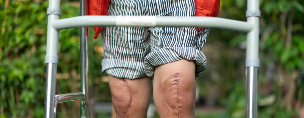 Unlocking Mobility: Post-Operative Exercises for Your Knees After Surgery